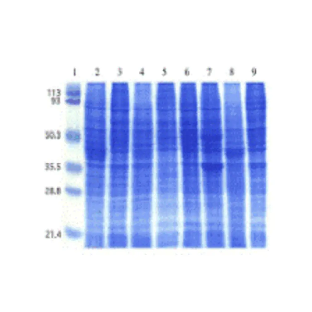 ProSci 1502 Human Cell Line II Blot, ProSci, One blot/Unit Primary Image