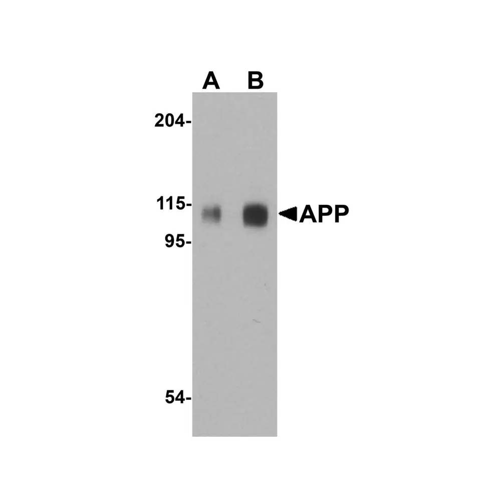 ProSci 2136 APP Antibody, ProSci, 0.1 mg/Unit Primary Image