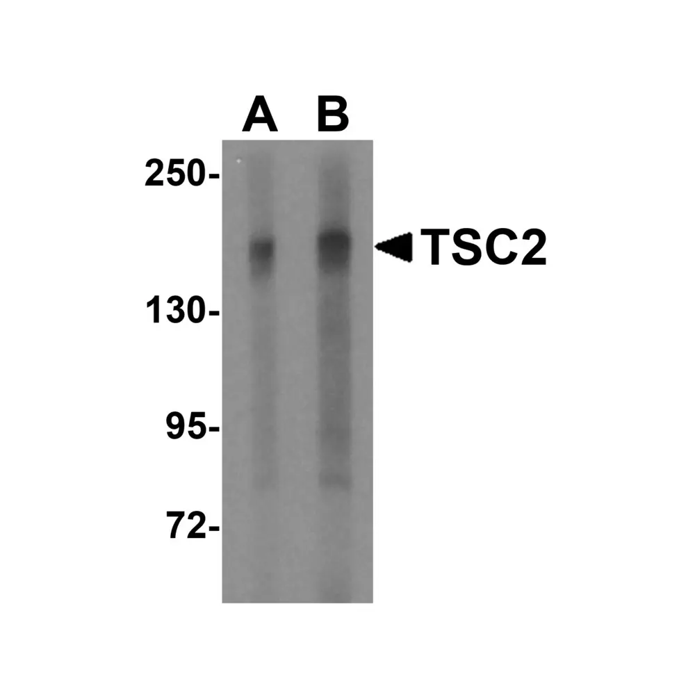 ProSci 3509 TSC2 Antibody, ProSci, 0.1 mg/Unit Primary Image