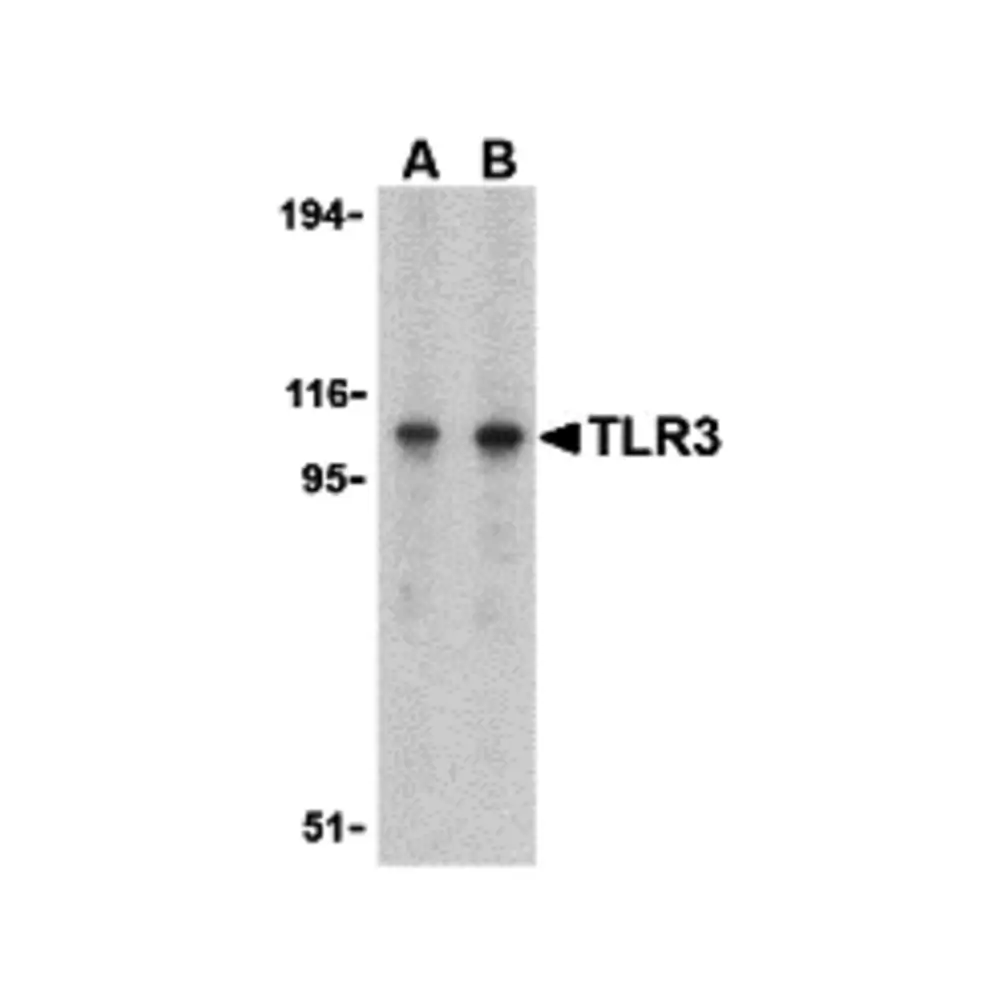 ProSci 3643 TLR3 Antibody, ProSci, 0.1 mg/Unit Primary Image