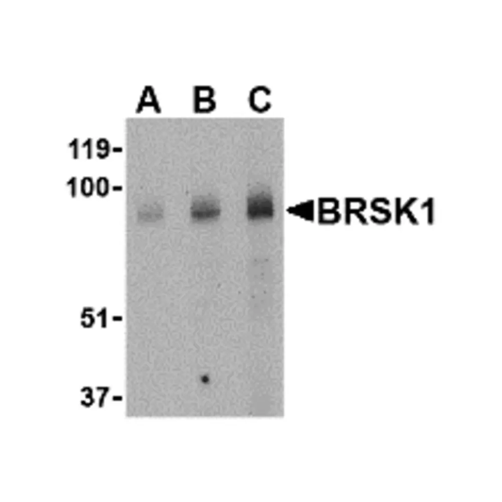 ProSci 4083 BRSK1 Antibody, ProSci, 0.1 mg/Unit Primary Image