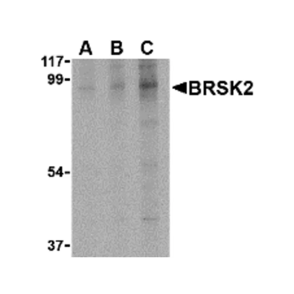 ProSci 4085_S BRSK2 Antibody, ProSci, 0.02 mg/Unit Primary Image