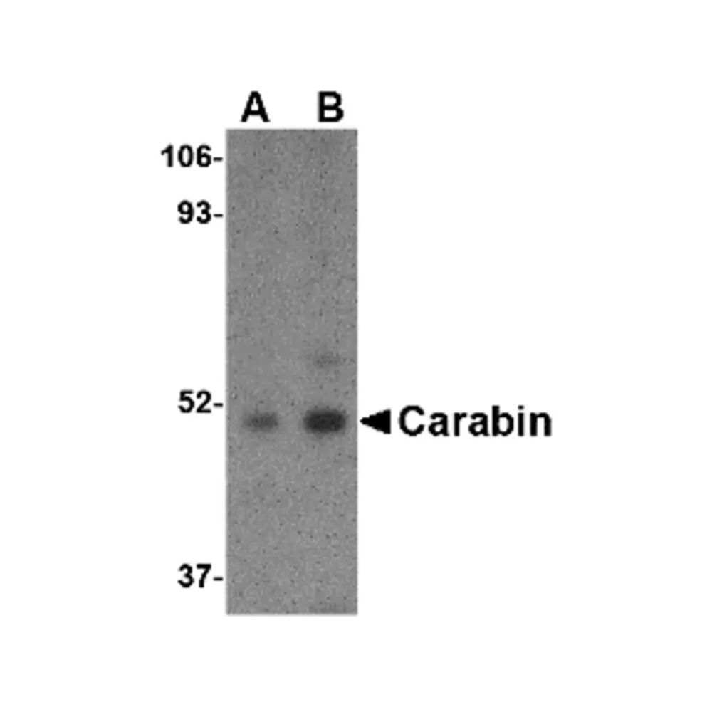 ProSci 4267 Carabin Antibody, ProSci, 0.1 mg/Unit Primary Image