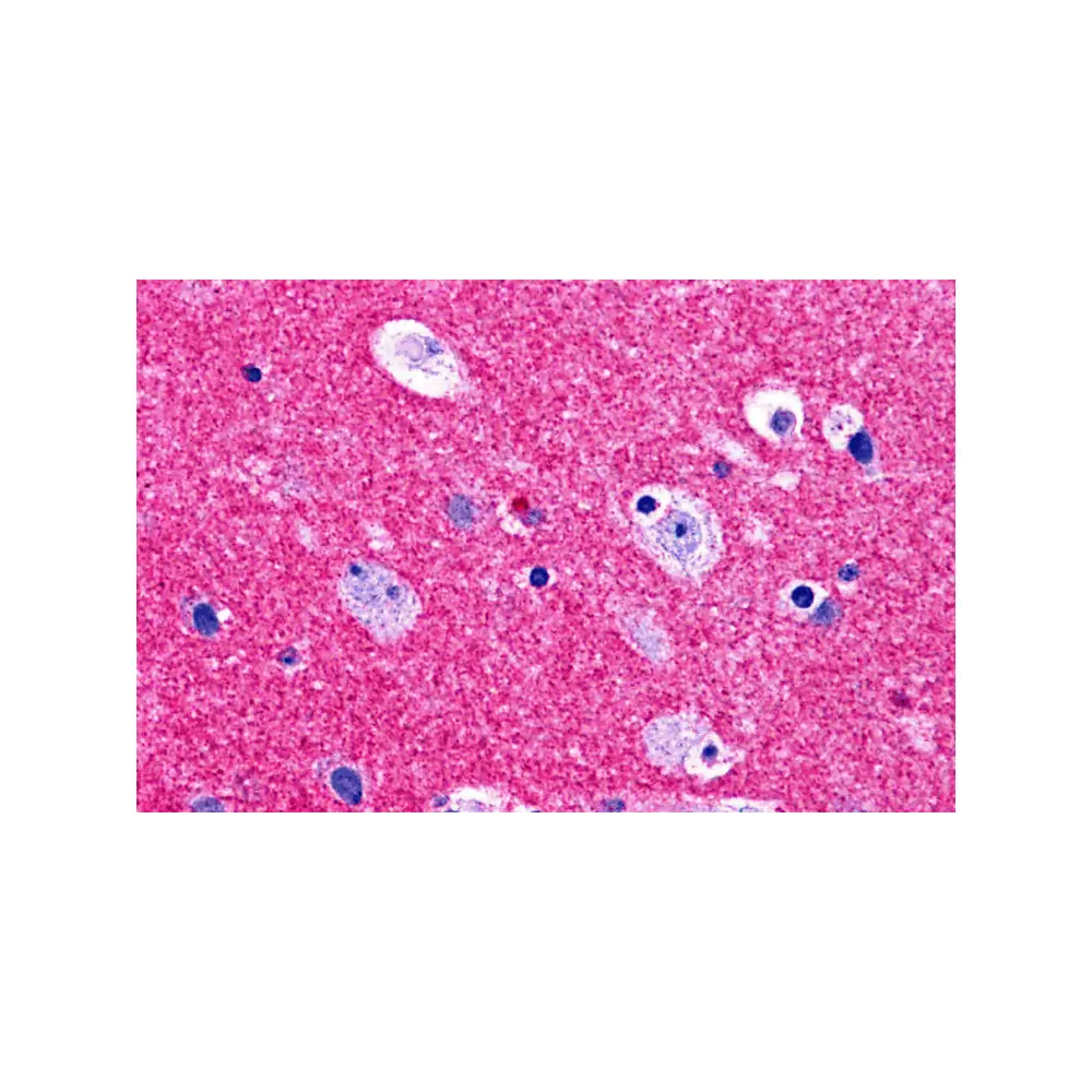 ProSci 4447 RIM2 Antibody, ProSci, 0.1 mg/Unit Primary Image