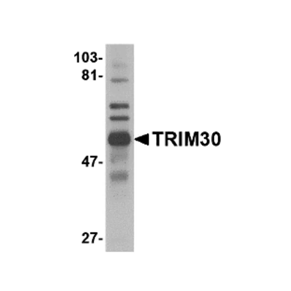 ProSci 4745_S TRIM30 Antibody, ProSci, 0.02 mg/Unit Primary Image