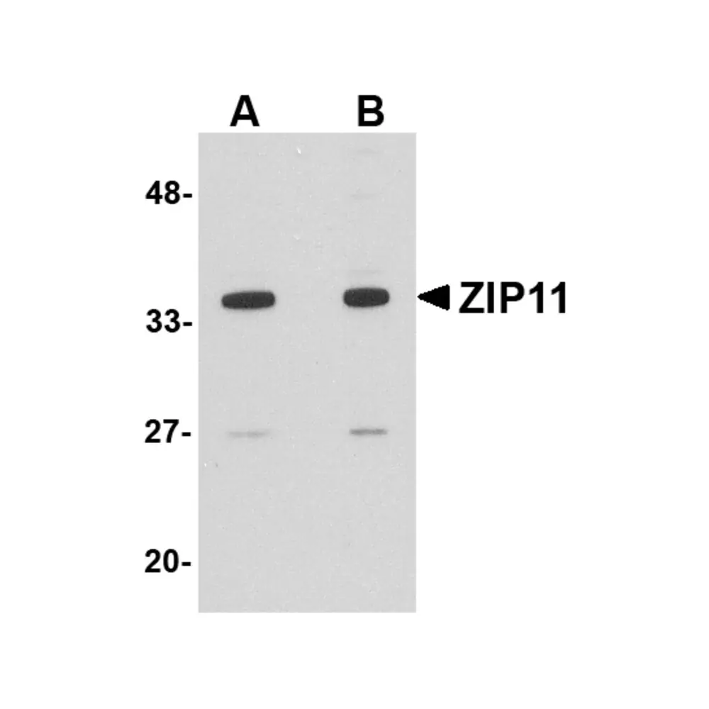 ProSci 5001 ZIP11 Antibody, ProSci, 0.1 mg/Unit Primary Image