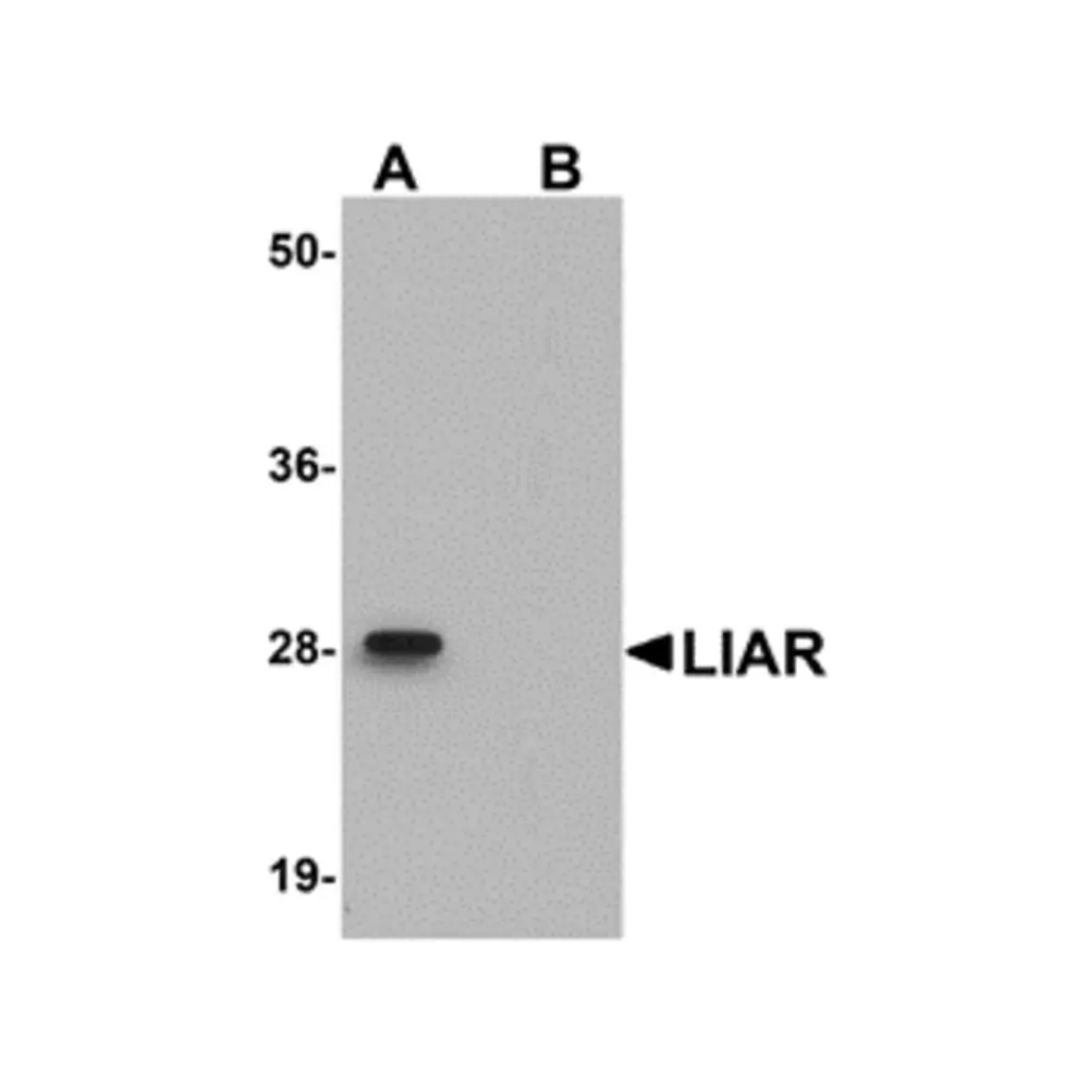 ProSci 5261_S LIAR Antibody, ProSci, 0.02 mg/Unit Primary Image