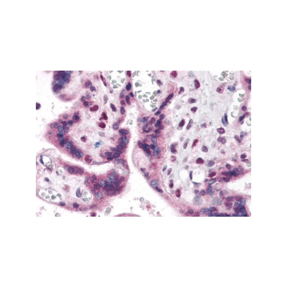 ProSci 5601_S IRF2BP2 Antibody, ProSci, 0.02 mg/Unit Primary Image