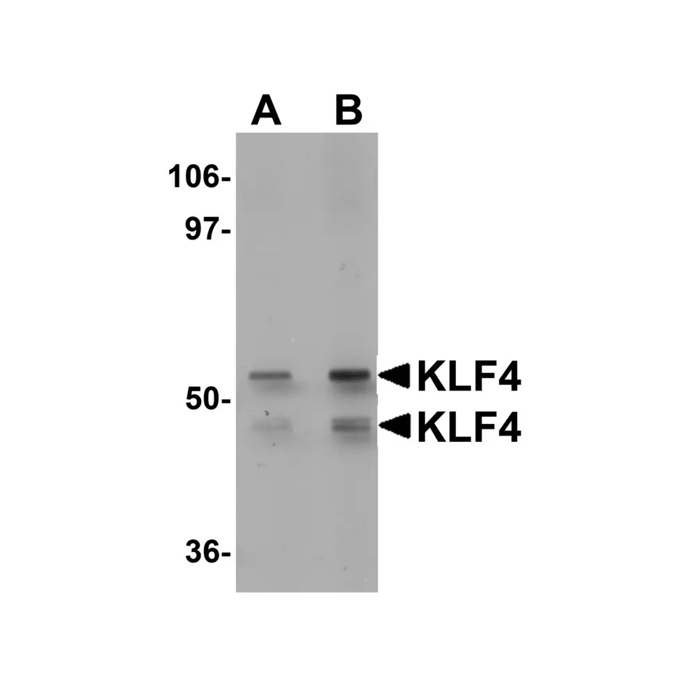 ProSci 5603 KLF4 Antibody, ProSci, 0.1 mg/Unit Primary Image