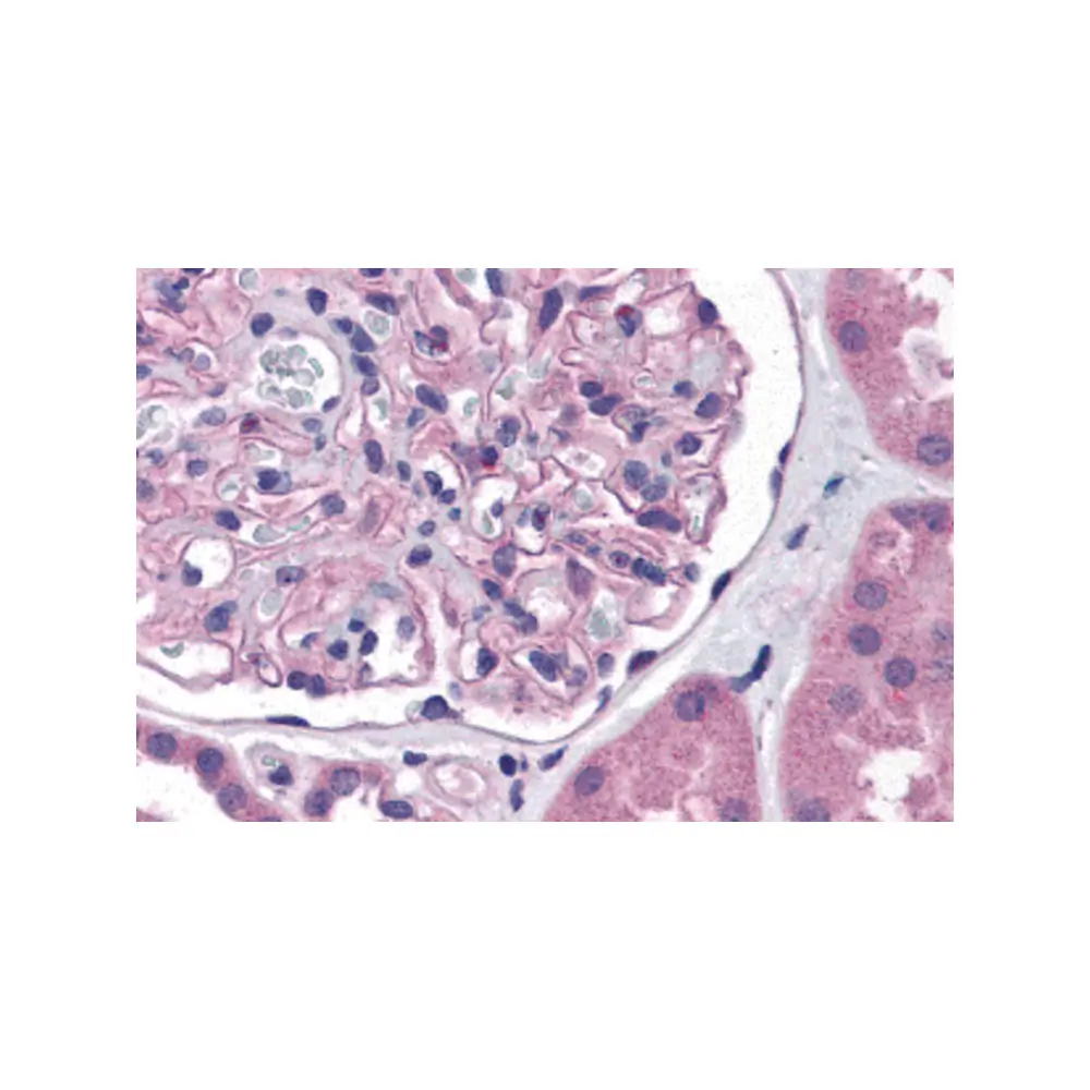 ProSci 5615 Nephrin Antibody, ProSci, 0.1 mg/Unit Primary Image