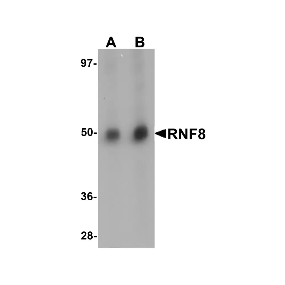 ProSci 5763_S RNF8 Antibody, ProSci, 0.02 mg/Unit Primary Image