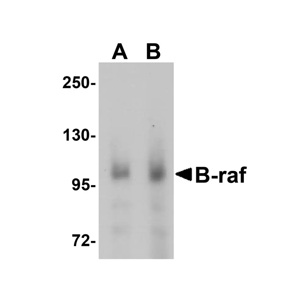 ProSci 5777_S B-raf Antibody, ProSci, 0.02 mg/Unit Primary Image