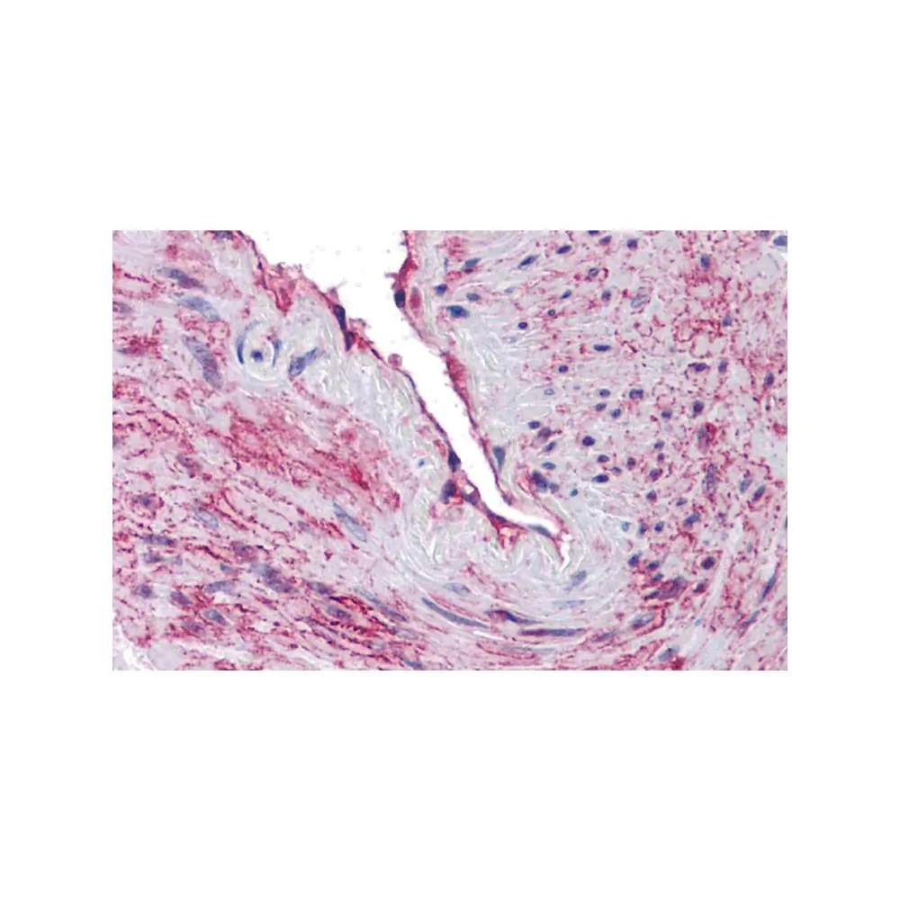 ProSci 5847_S SCUBE3 Antibody, ProSci, 0.02 mg/Unit Primary Image