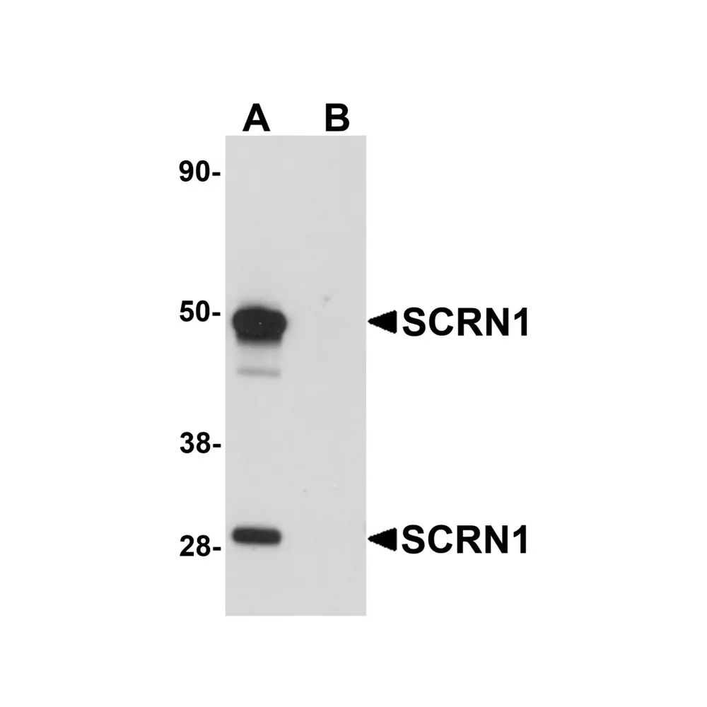 ProSci 5849_S SCRN1 Antibody, ProSci, 0.02 mg/Unit Primary Image