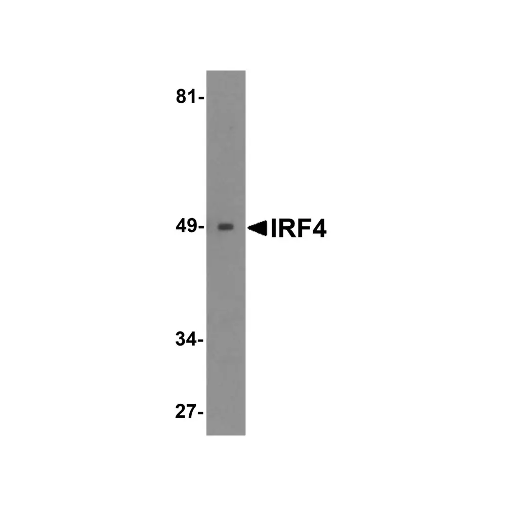 ProSci 6307_S IRF4 Antibody, ProSci, 0.02 mg/Unit Primary Image