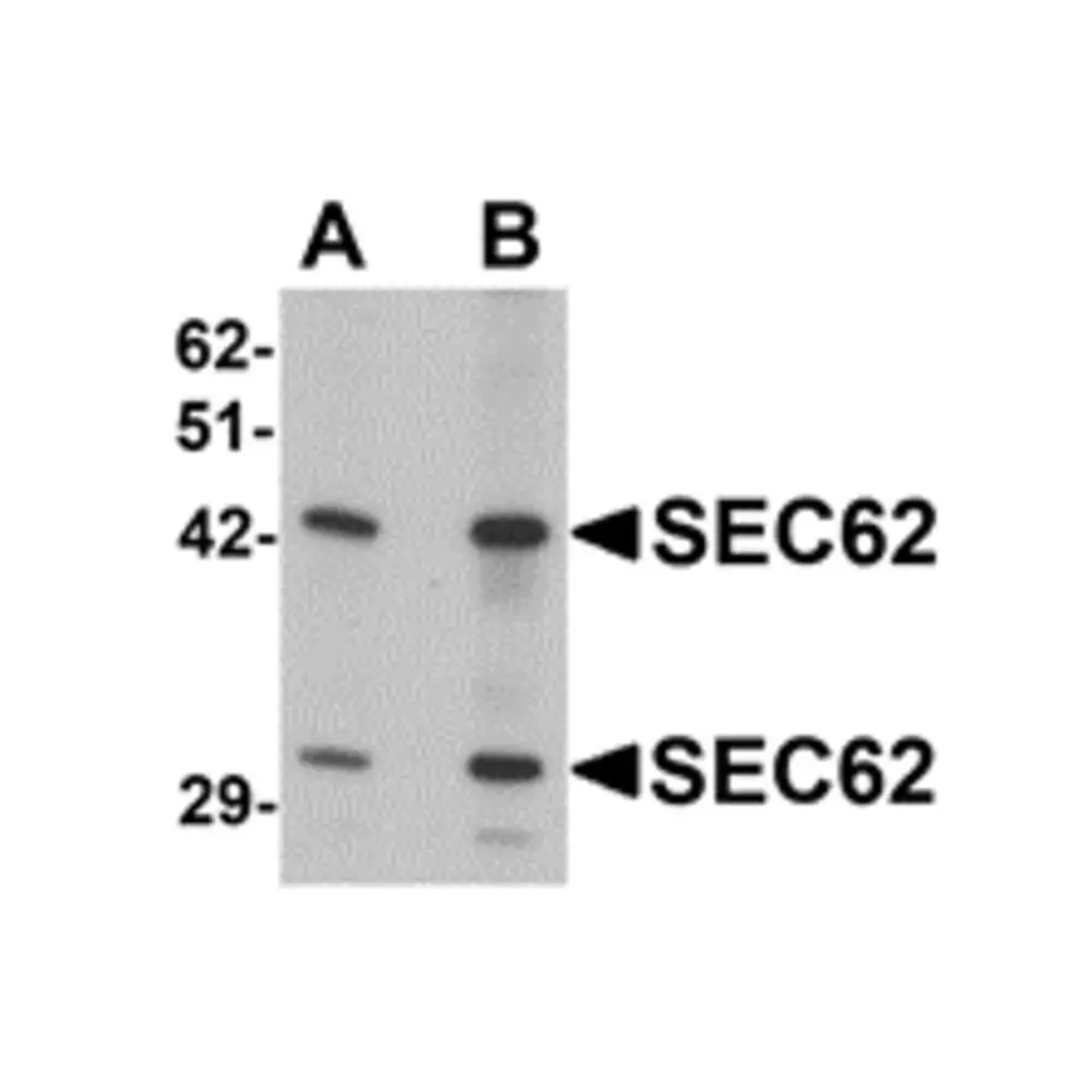 ProSci 6471 SEC62 Antibody, ProSci, 0.1 mg/Unit Primary Image