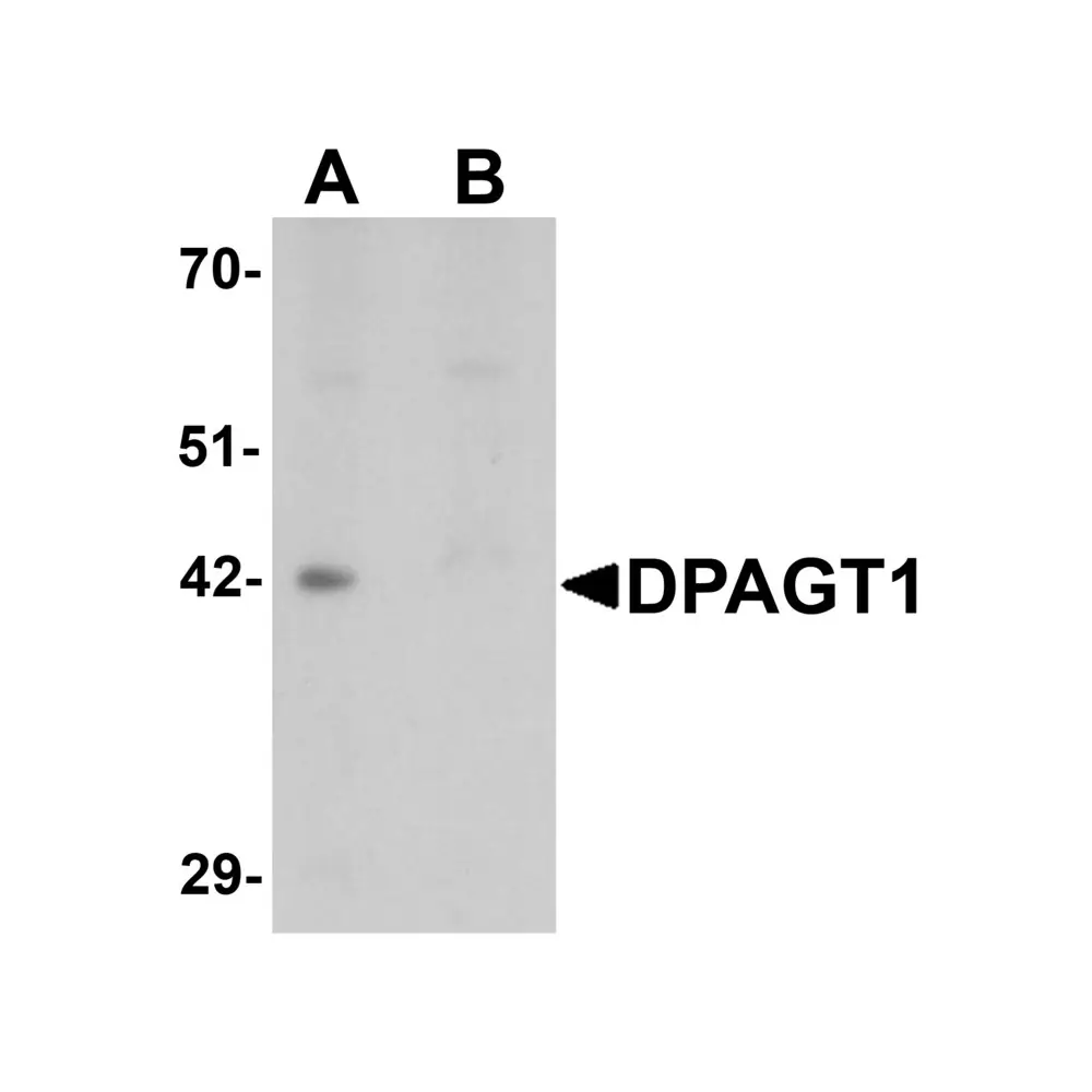 ProSci 6485_S DPAGT1 Antibody, ProSci, 0.02 mg/Unit Primary Image