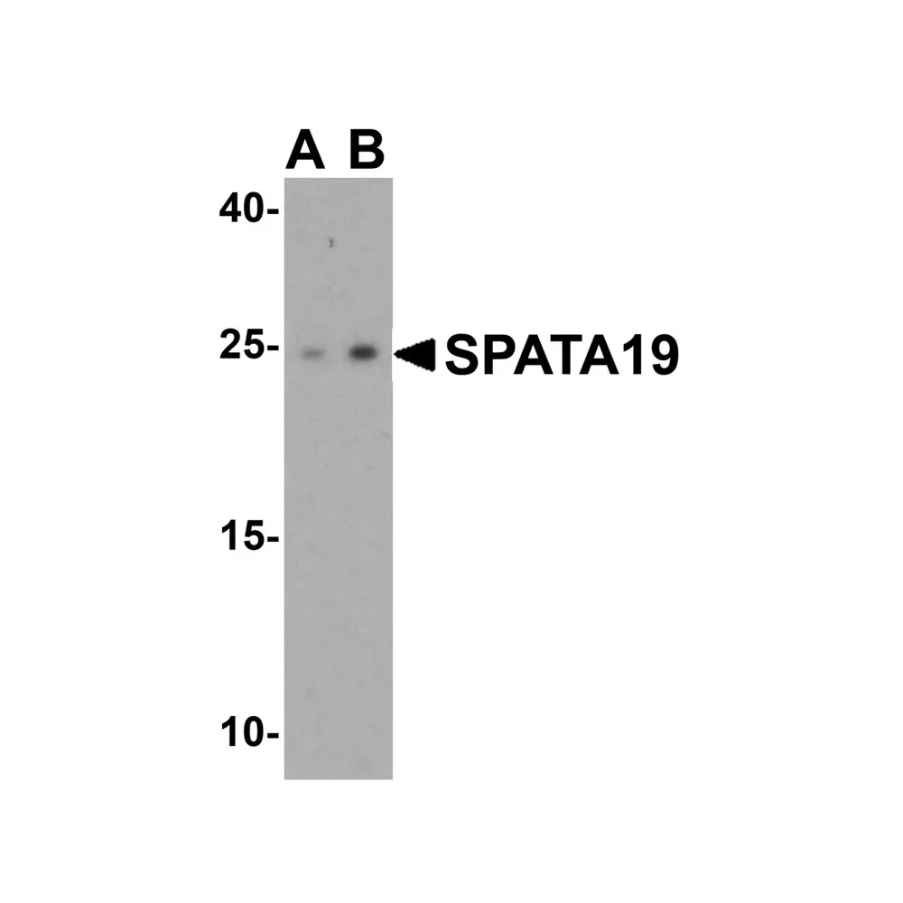 ProSci 6617_S SPATA19 Antibody, ProSci, 0.02 mg/Unit Primary Image