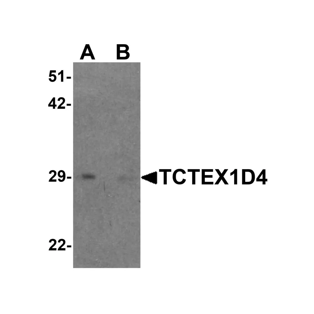 ProSci 6957 TCTEX1D4 Antibody, ProSci, 0.1 mg/Unit Primary Image