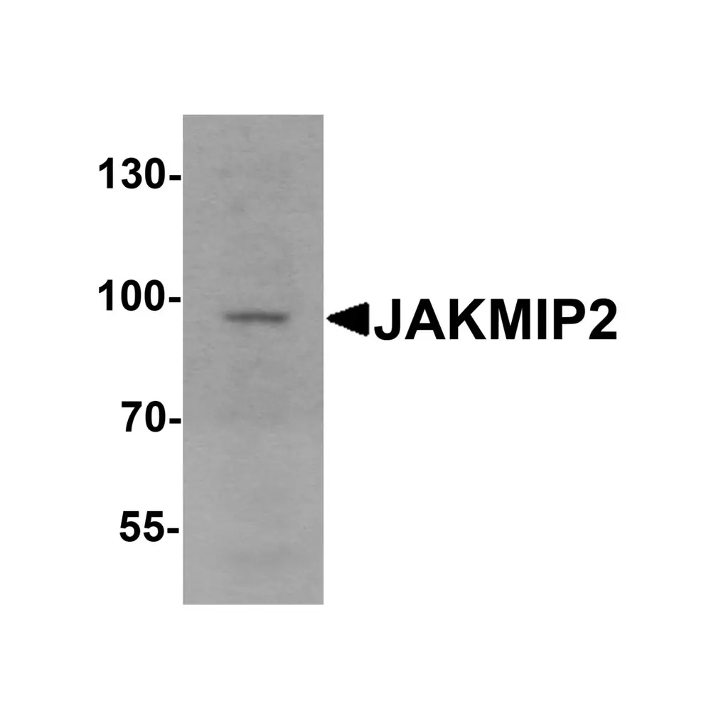 ProSci 7167_S JAKMIP2 Antibody, ProSci, 0.02 mg/Unit Primary Image