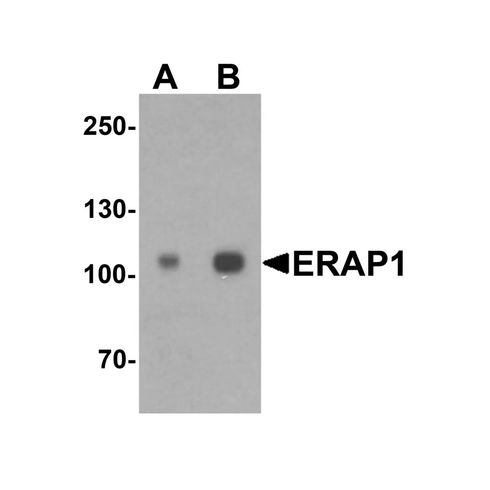 ProSci 7467_S ERAP1 Antibody , ProSci, 0.02 mg/Unit Primary Image