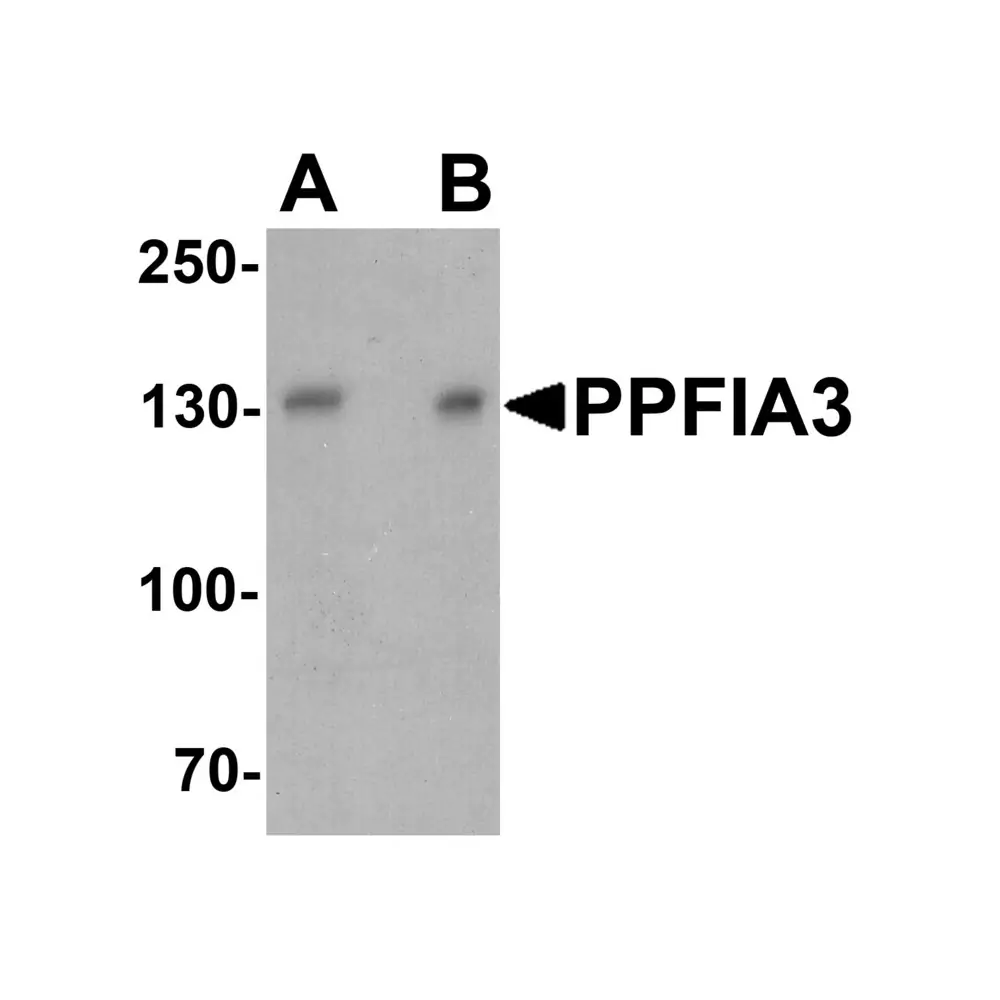 ProSci 7561 PPFIA3 Antibody, ProSci, 0.1 mg/Unit Primary Image