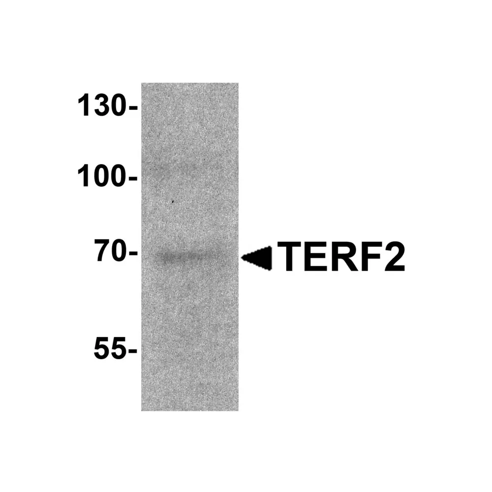 ProSci 7727 TERF2 Antibody, ProSci, 0.1 mg/Unit Primary Image