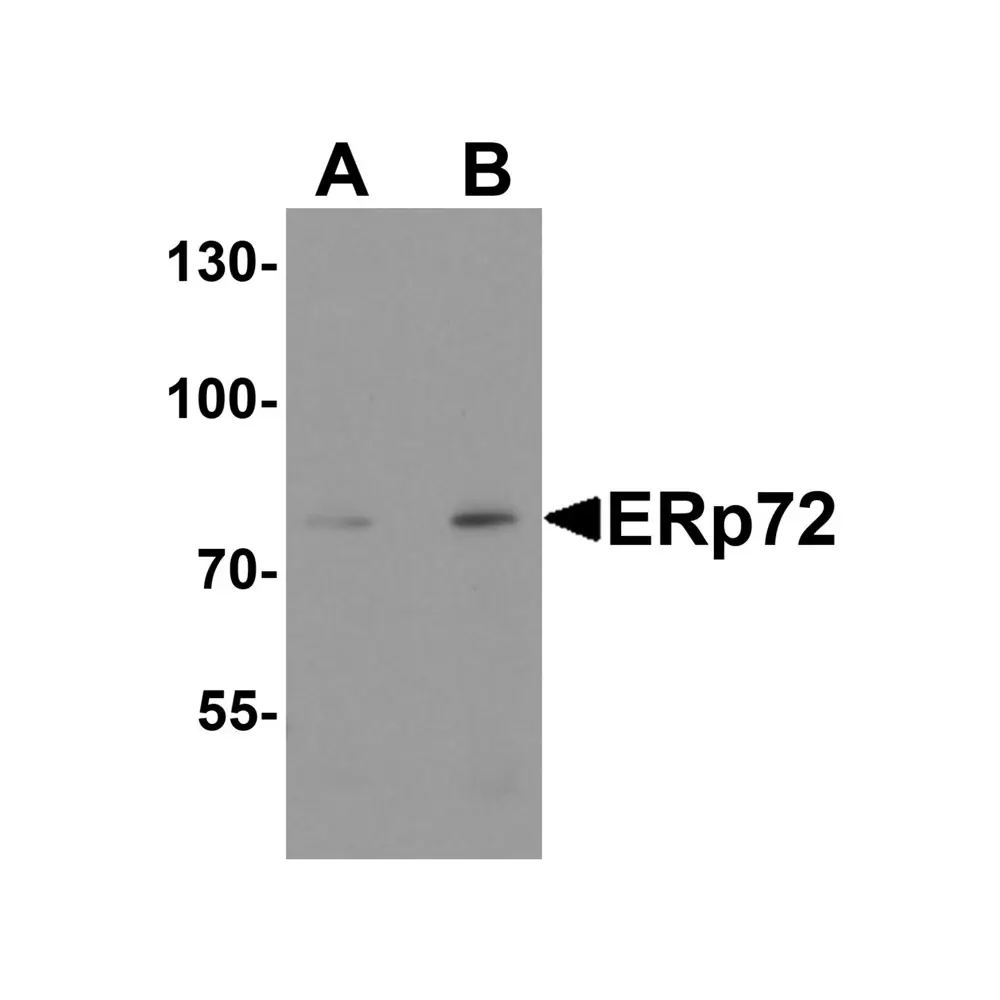 ProSci 8211 ERp72 Antibody, ProSci, 0.1 mg/Unit Primary Image