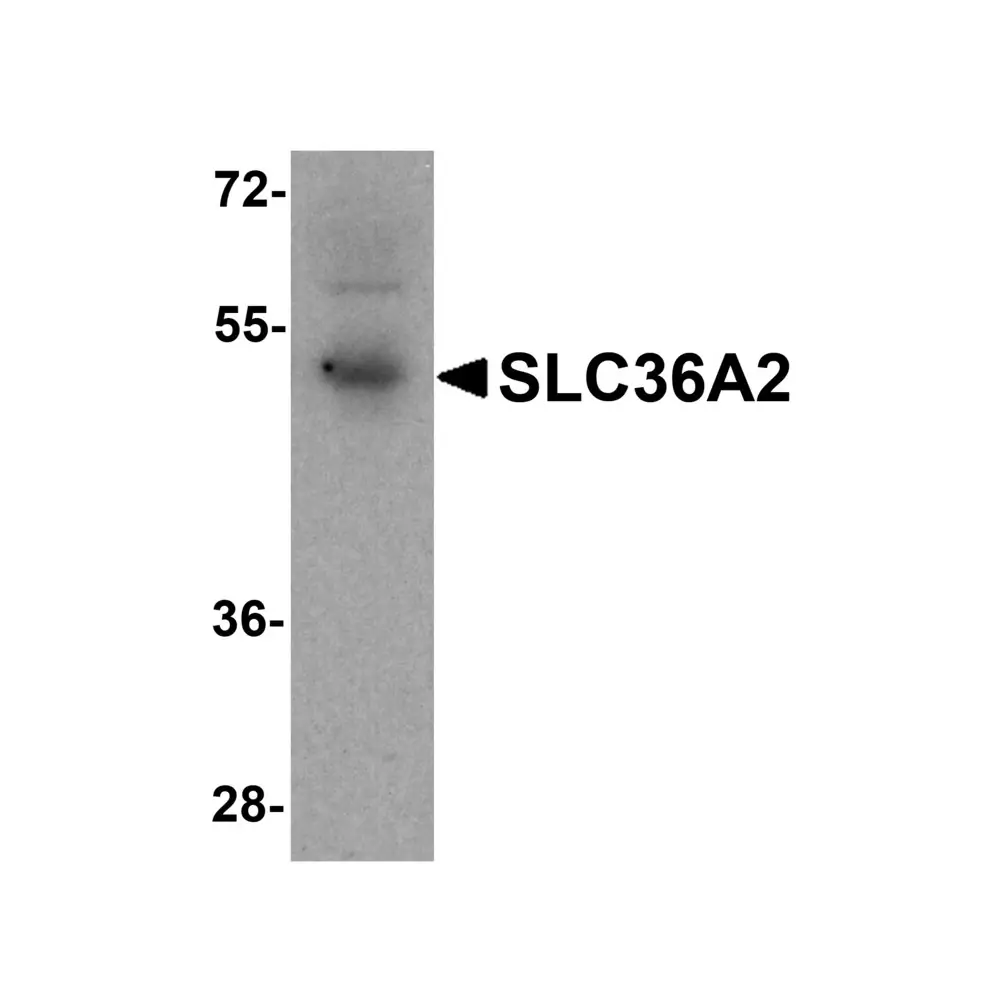 ProSci 8341 SLC36A2 Antibody, ProSci, 0.1 mg/Unit Primary Image