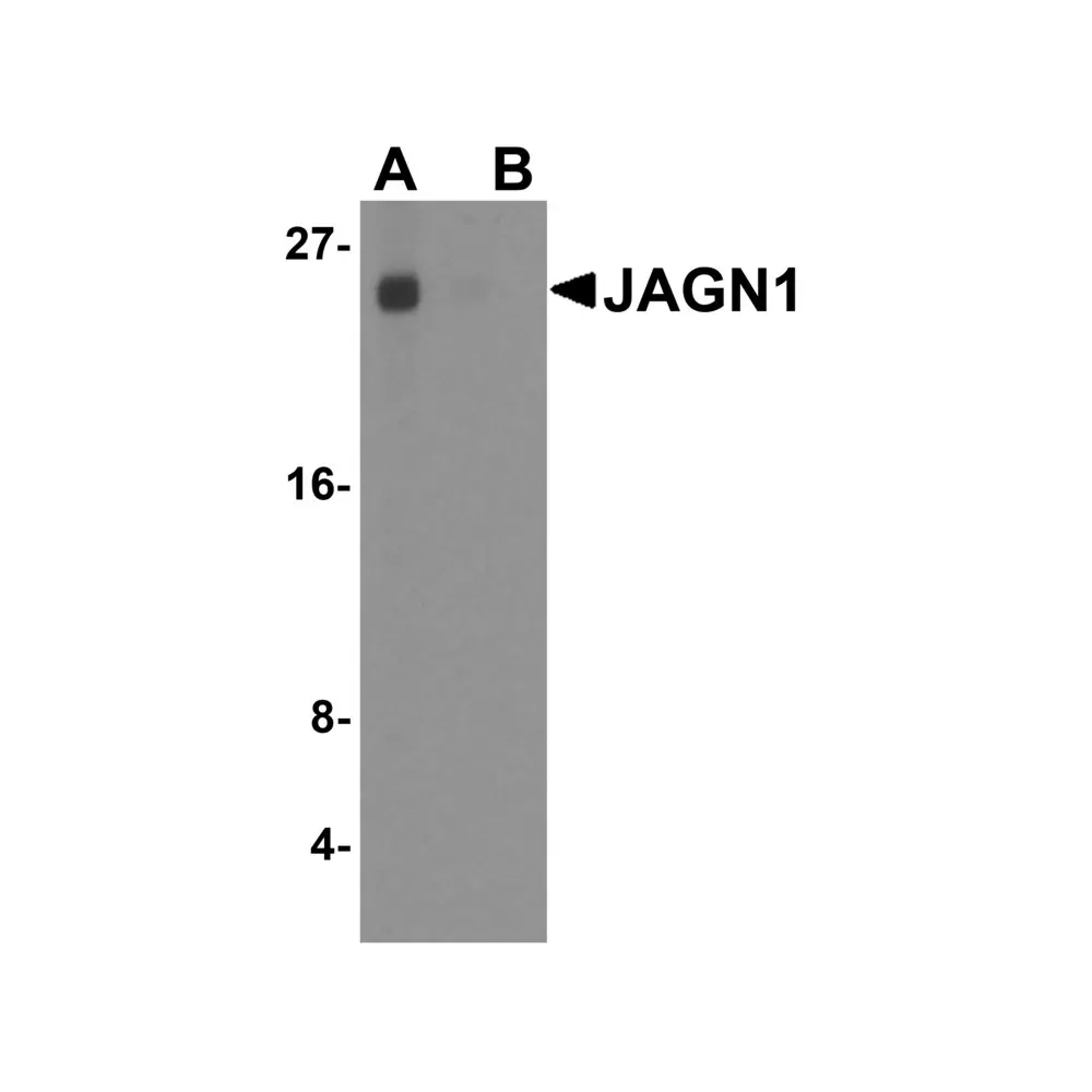 ProSci 8367_S JAGN1 Antibody, ProSci, 0.02 mg/Unit Primary Image