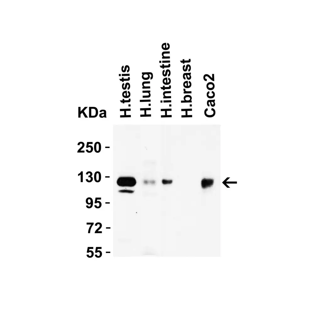 ProSci 3217_S ACE2 Antibody, ProSci, 0.02 mg/Unit Secondary Image