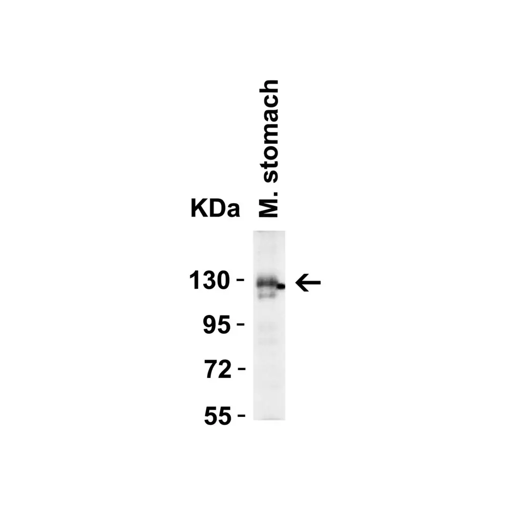 ProSci 3229_S ACE2 Antibody, ProSci, 0.02 mg/Unit Secondary Image