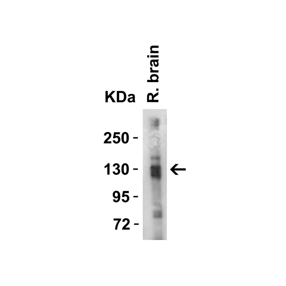 ProSci 3229_S ACE2 Antibody, ProSci, 0.02 mg/Unit Tertiary Image