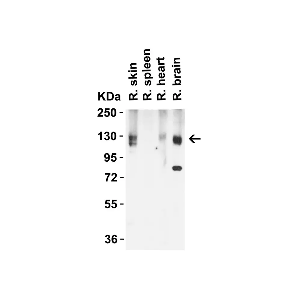 ProSci 3217_S ACE2 Antibody, ProSci, 0.02 mg/Unit Quaternary Image