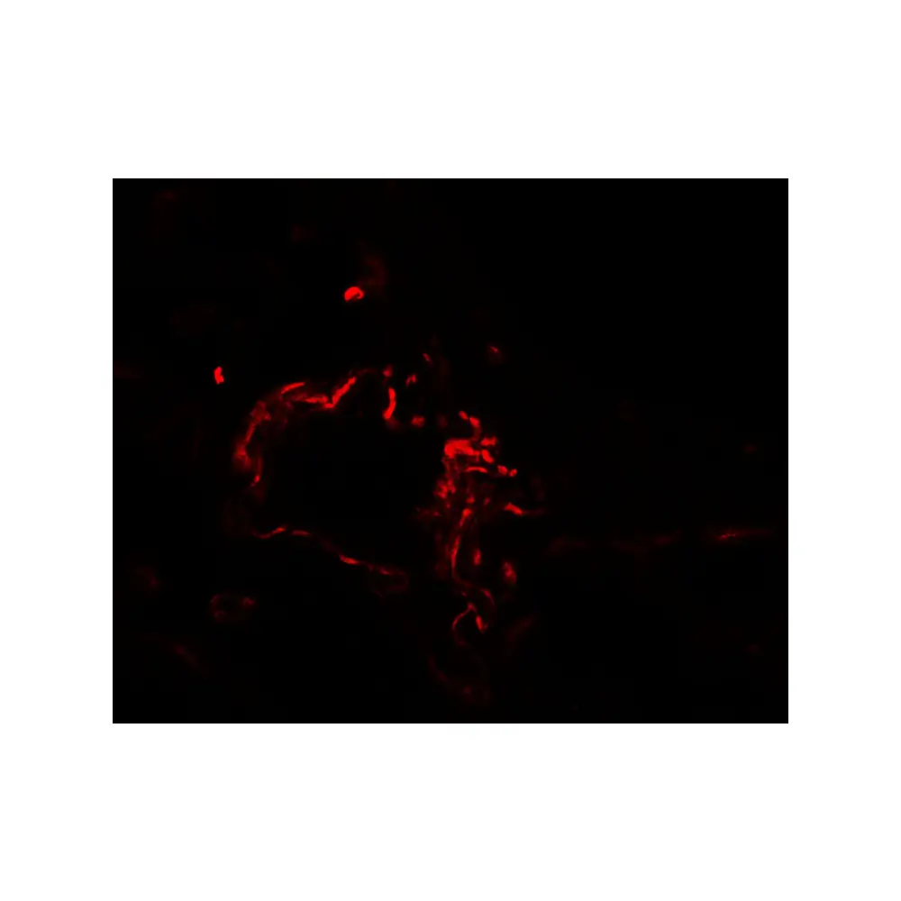 ProSci 7081 ACSL1 Antibody, ProSci, 0.1 mg/Unit Secondary Image