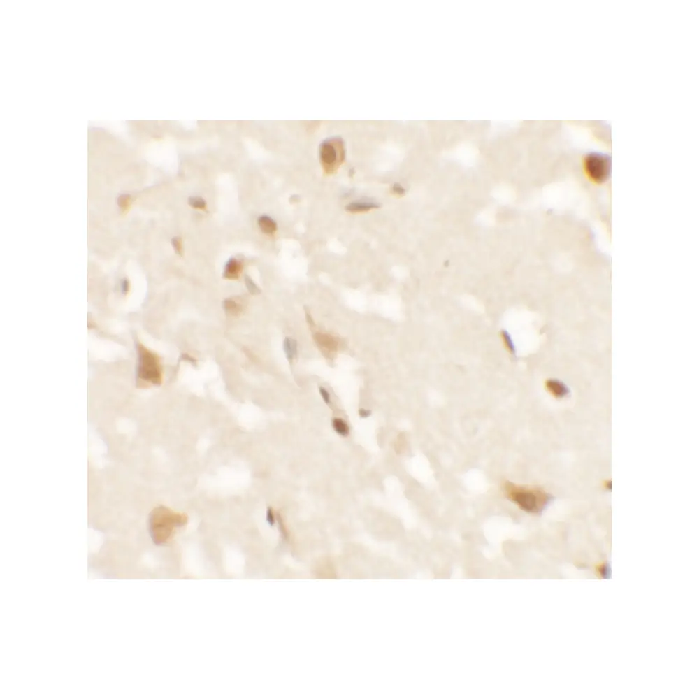 ProSci 6785_S AIG1 Antibody, ProSci, 0.02 mg/Unit Secondary Image