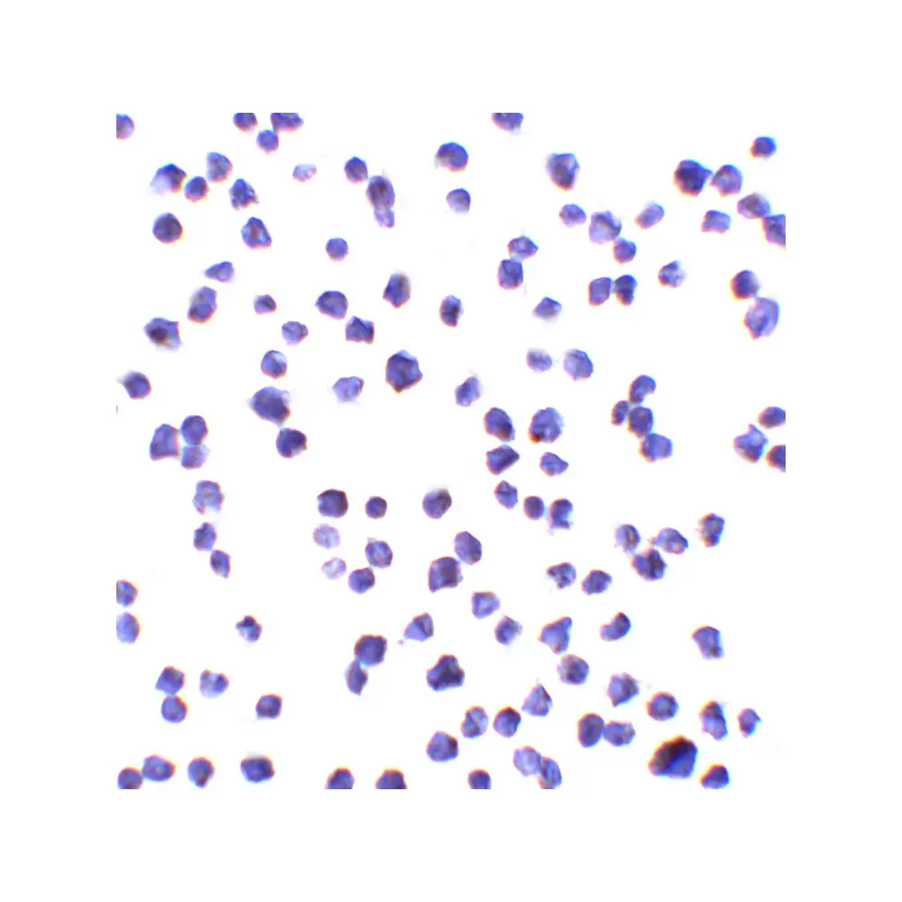 ProSci 8469 ALSFTD Antibody, ProSci, 0.1 mg/Unit Secondary Image