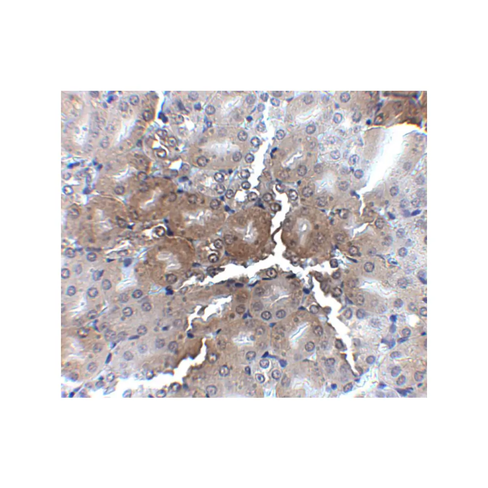 ProSci 5161 AP2M1 Antibody, ProSci, 0.1 mg/Unit Secondary Image