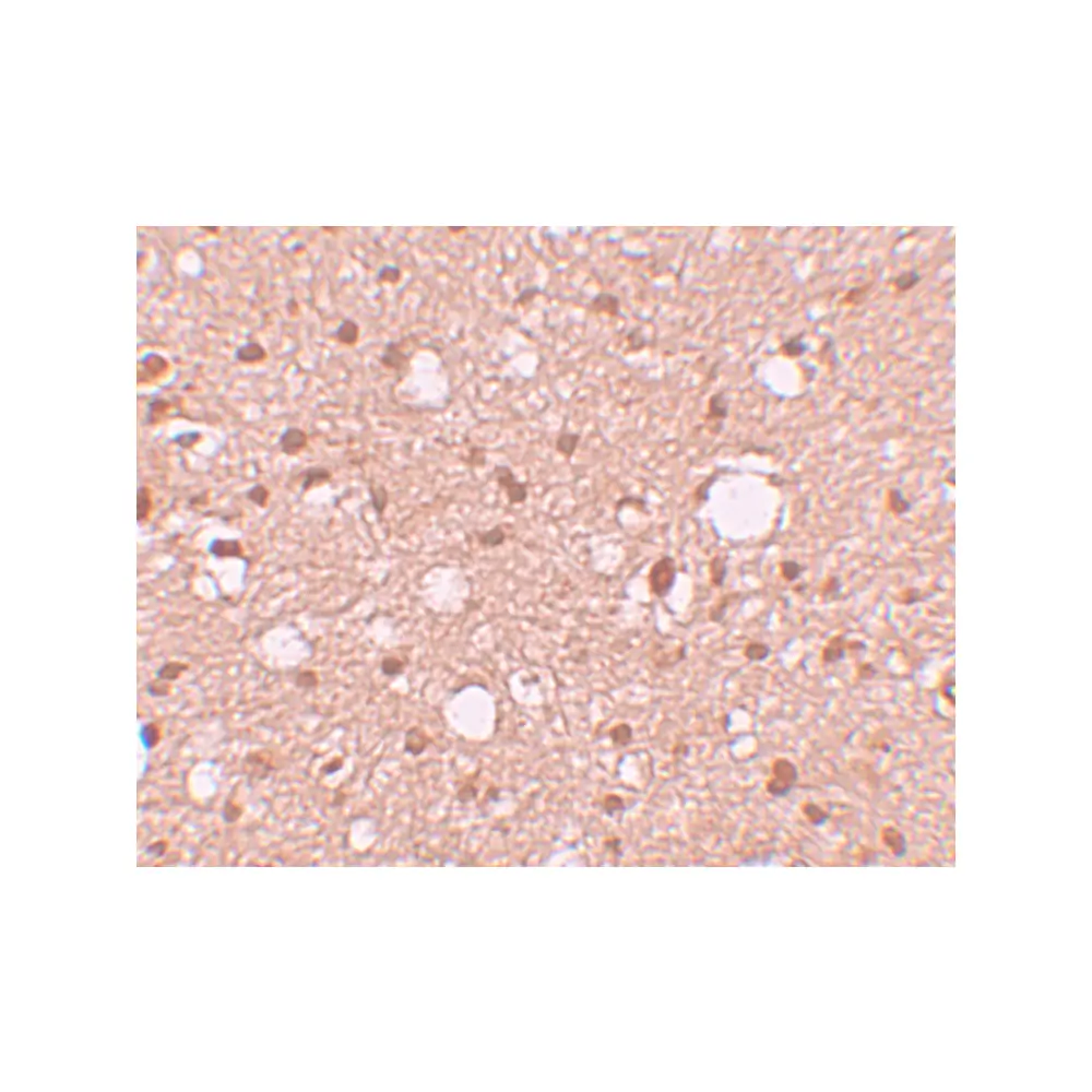 ProSci 6039 APBA2 Antibody, ProSci, 0.1 mg/Unit Secondary Image