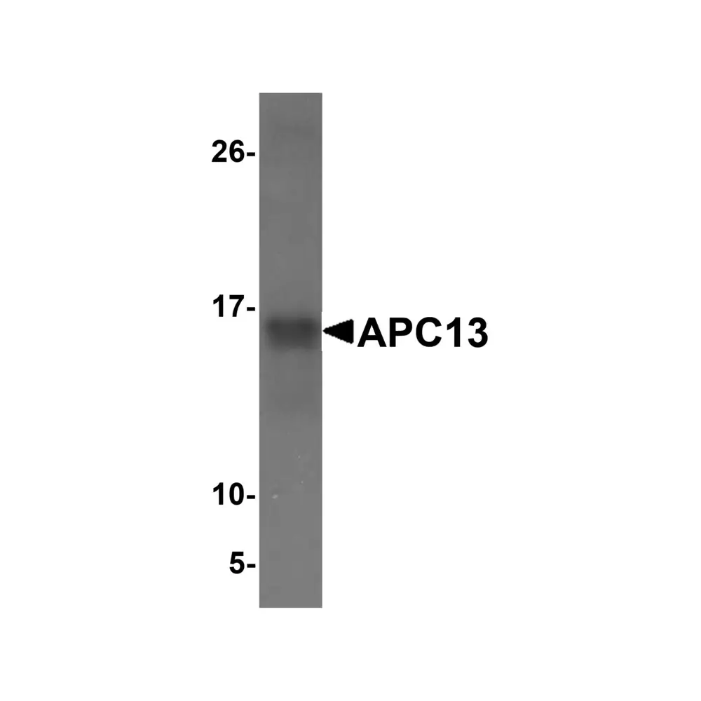 ProSci 5739_S APC13 Antibody, ProSci, 0.02 mg/Unit Tertiary Image