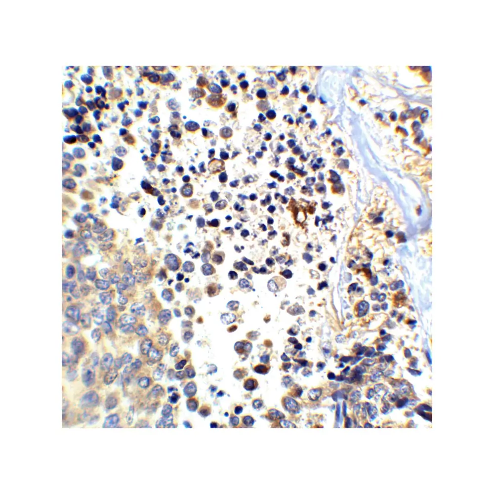 ProSci 2133 APP Antibody, ProSci, 0.1 mg/Unit Tertiary Image