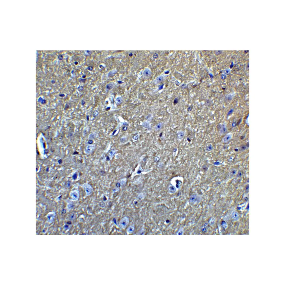 ProSci 2136 APP Antibody, ProSci, 0.1 mg/Unit Quaternary Image