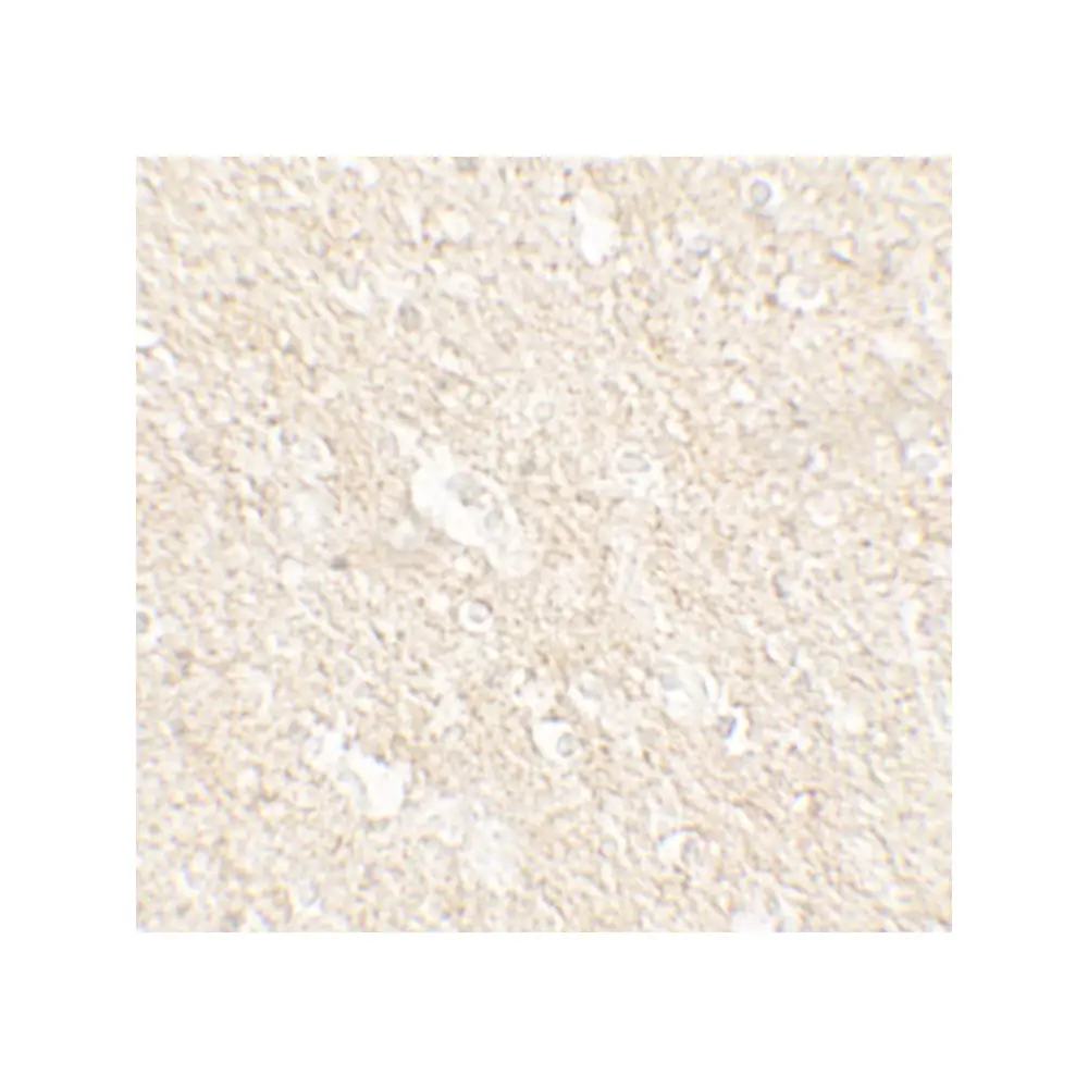 ProSci 7563_S APPBP2 Antibody, ProSci, 0.02 mg/Unit Secondary Image