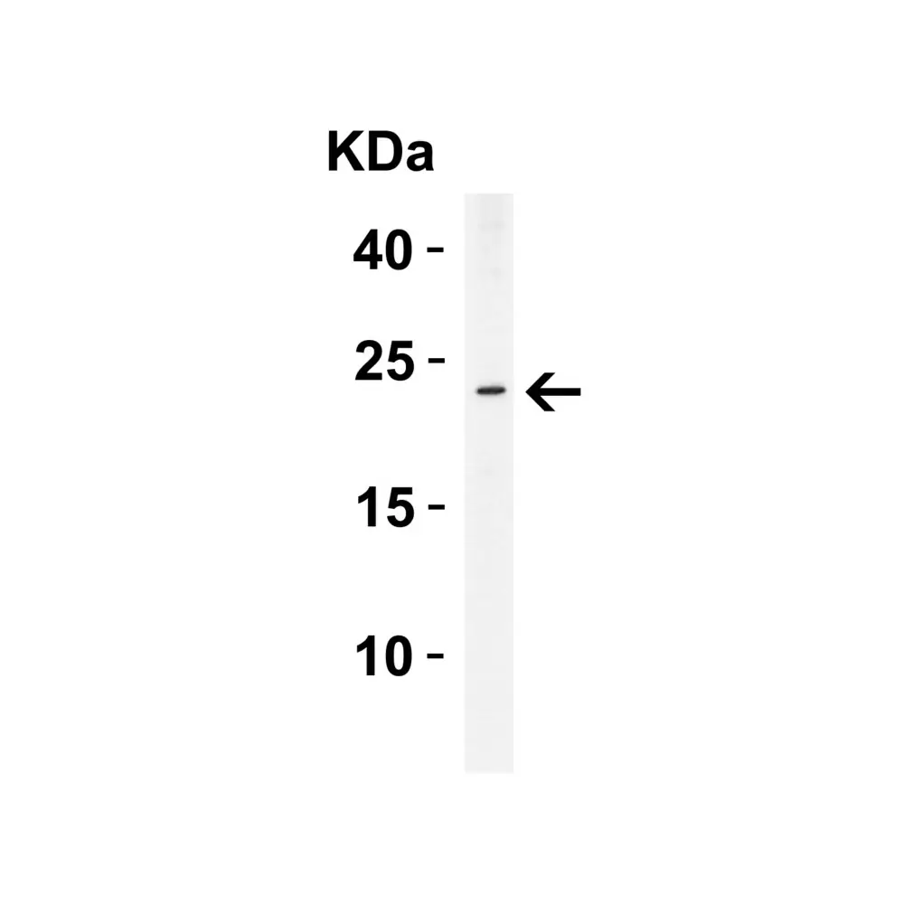 ProSci 2287_S ASC Antibody, ProSci, 0.02 mg/Unit Tertiary Image