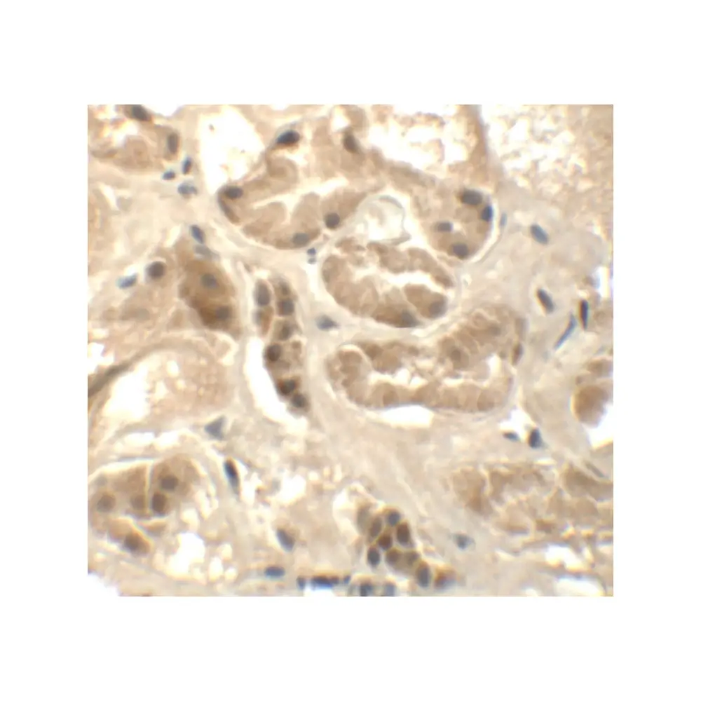 ProSci 6389 ATAD3B Antibody, ProSci, 0.1 mg/Unit Secondary Image