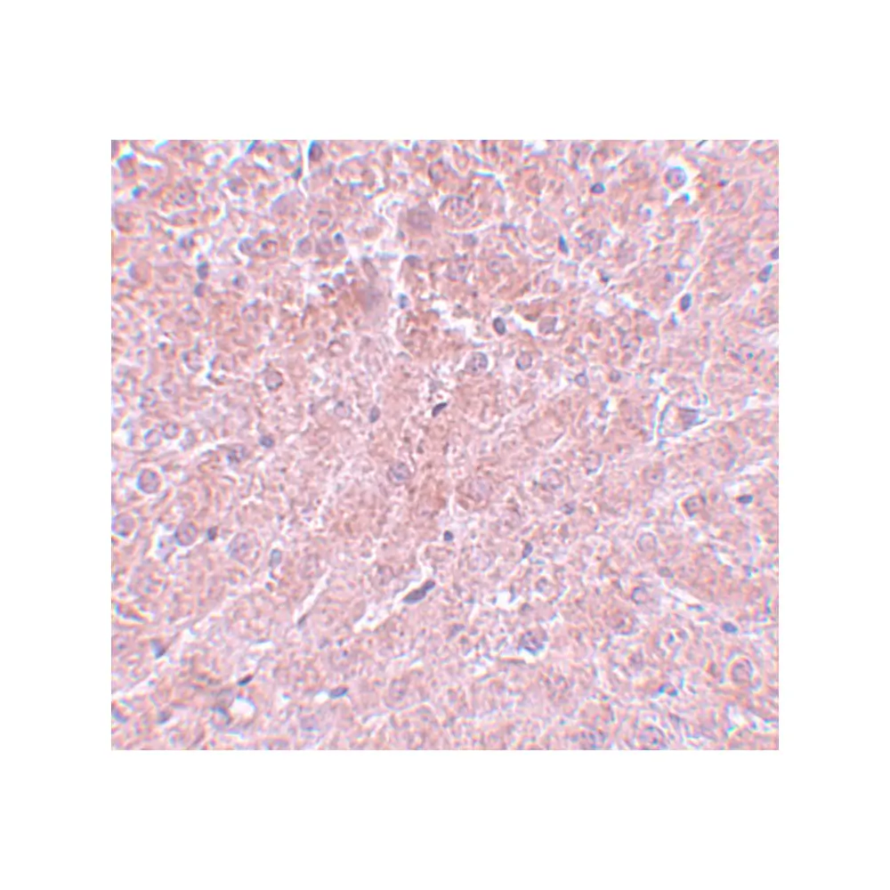 ProSci 5801 ATG101 Antibody, ProSci, 0.1 mg/Unit Secondary Image