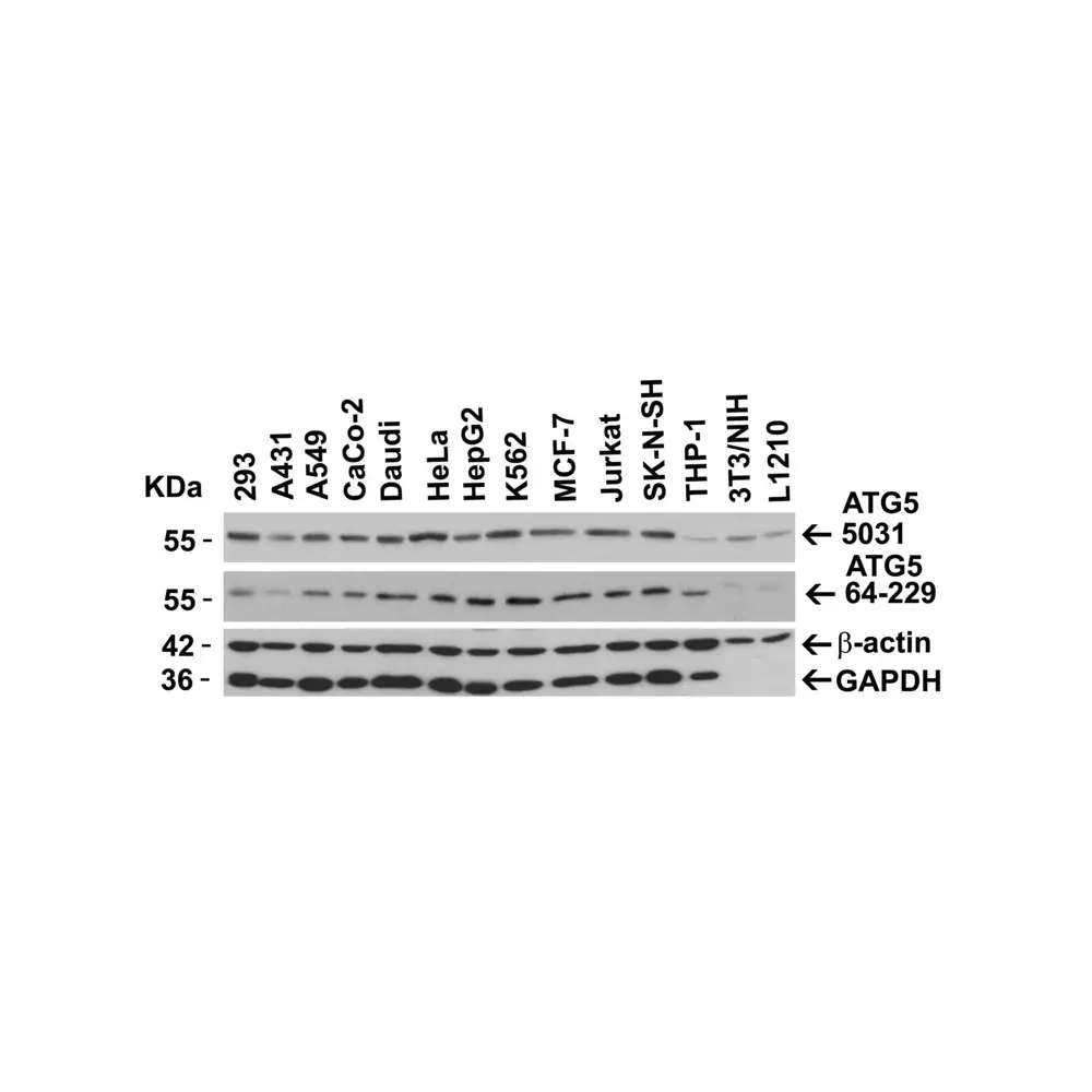 ProSci 5031 ATG5 Antibody, ProSci, 0.1 mg/Unit Secondary Image