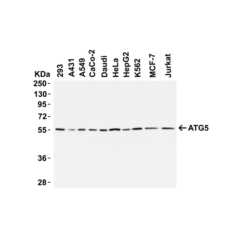 ProSci 5031 ATG5 Antibody, ProSci, 0.1 mg/Unit Tertiary Image