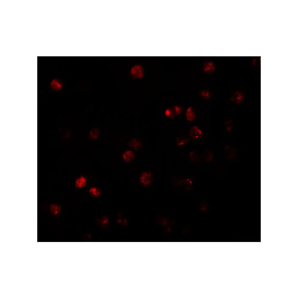 ProSci 5857_S ATP11B Antibody, ProSci, 0.02 mg/Unit Tertiary Image