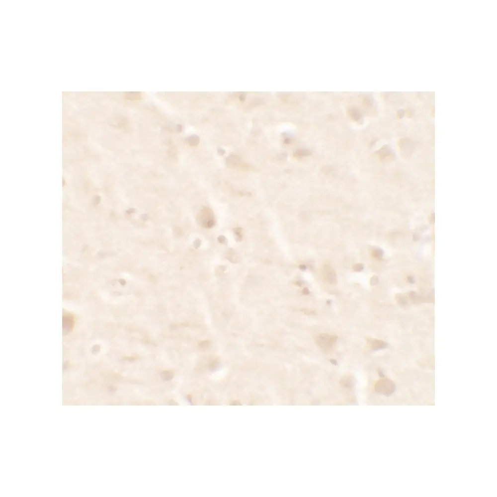 ProSci 7439_S B2M Antibody, ProSci, 0.02 mg/Unit Secondary Image